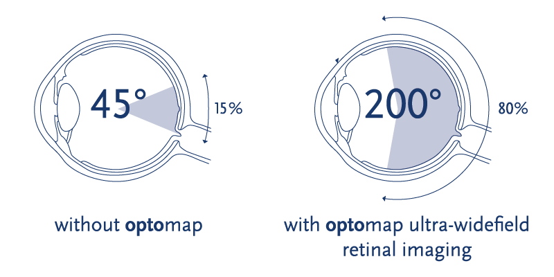 Optomap graphic