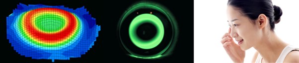 Myopia Management